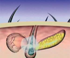 Hair Grow Max 2x1 a 214 PLN