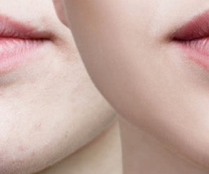 Vacu Clear a 248 LEU