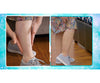 Veins Gone 2x1 a 972 CZK